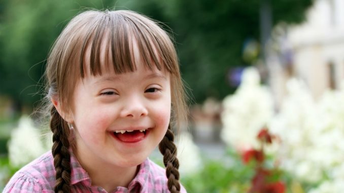 down_syndrome