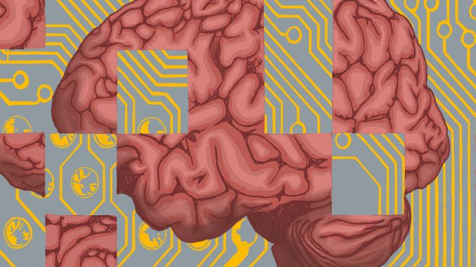 AI-Alzheimers