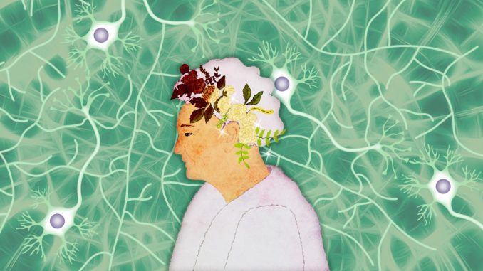 Alzheimers-1